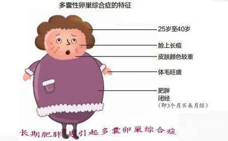 肥胖最招惹婦科疾病，你知道嗎？