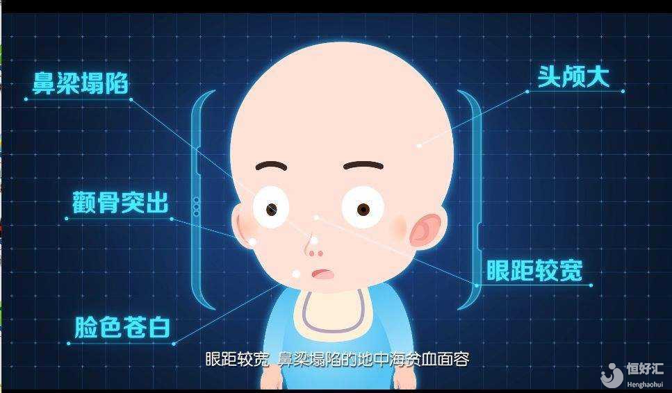 疑問(wèn)解答：做試管嬰兒會(huì)患有地中海貧血嗎？