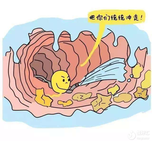 弄清子宮輸卵管造影的優缺點，這篇文就夠了！