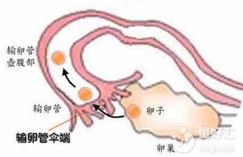 卵子排不到右側(cè)輸卵管怎么辦？或許你可以這樣做