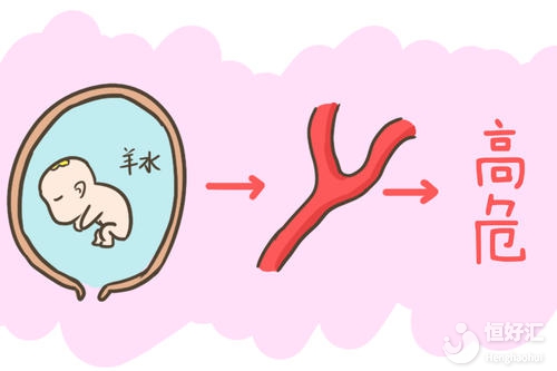 為什么醫(yī)生會(huì)害怕產(chǎn)婦咳嗽？其原因不敢相信