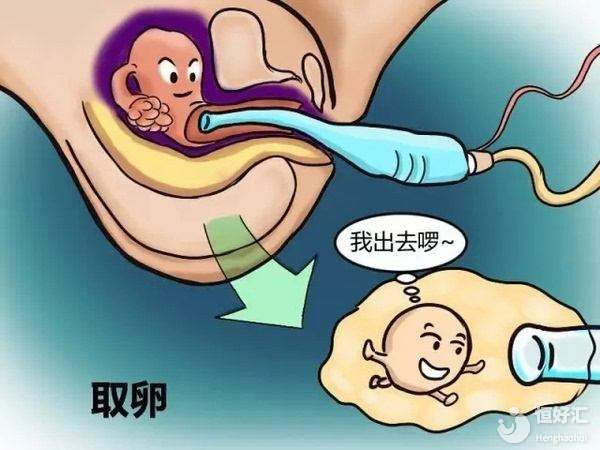 試管嬰兒取卵后的注意事項，助你快速恢復！