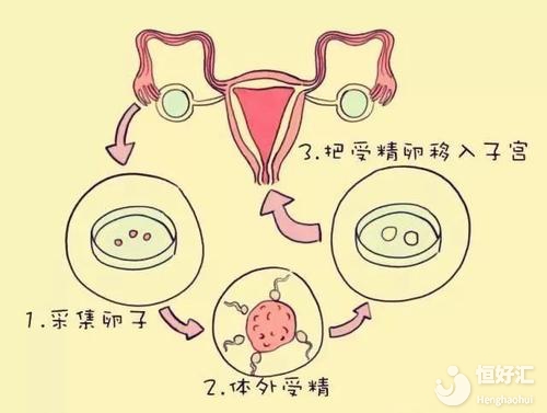 試管嬰兒“回家”過程你都知道嗎？真相在這里