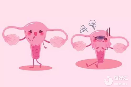 你知道什么是子宮內(nèi)膜異位癥嗎?這里給你答案