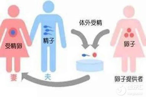 供卵試管很難一次成功？這4個(gè)因素很重要