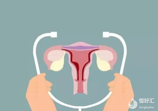 <strong>巧克力囊腫就是子宮內膜異位癥嗎？可以懷孕嗎？</strong>