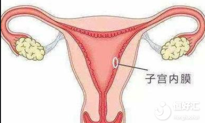 子宮內(nèi)膜厚怎么做試管嬰兒? 子宮內(nèi)膜厚怎么做試管嬰兒?