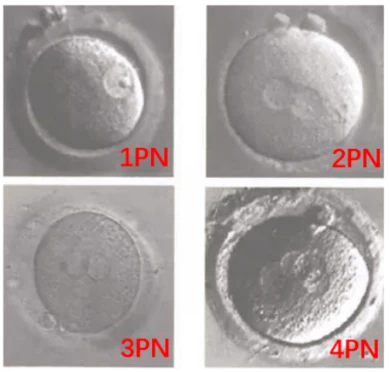 醫生常說的：2PN、0PN、1PN是什么意思？有什區別？