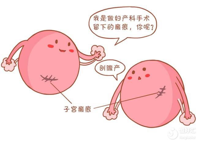 瘢痕子宮是什么？能做試管嬰兒?jiǎn)幔? />
									<div   id=
